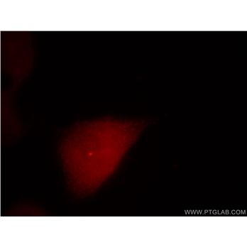 CETN1 Rabbit Polyclonal Antibody (12794-1-AP)