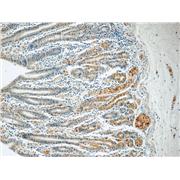 SMAP1 Rabbit Polyclonal Antibody (12799-1-AP)
