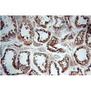 HDAC6 Rabbit Polyclonal Antibody (12834-1-AP)