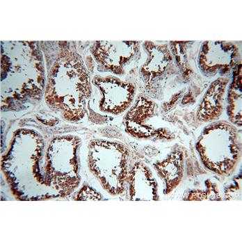 HDAC6 Rabbit Polyclonal Antibody (12834-1-AP)