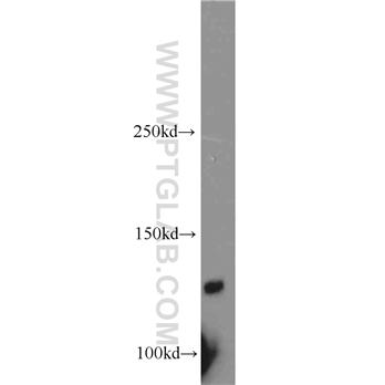 PLEKHA5 Rabbit Polyclonal Antibody (13045-1-AP)