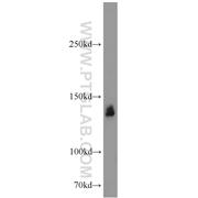 SRRM1 Rabbit Polyclonal Antibody (12822-1-AP)