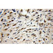 TRIM69 Rabbit Polyclonal Antibody (12951-1-AP)