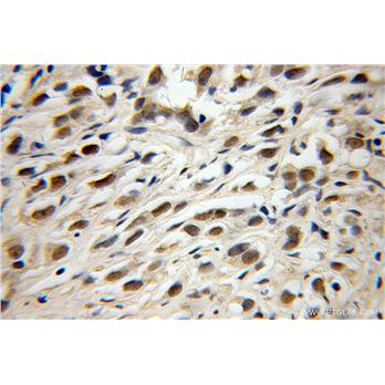 TRIM69 Rabbit Polyclonal Antibody (12951-1-AP)