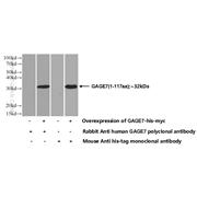GAGE7 Rabbit Polyclonal Antibody (12945-1-AP)