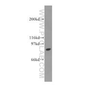 STAT4 Rabbit Polyclonal Antibody (13028-1-AP)