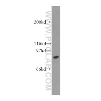STAT4 Rabbit Polyclonal Antibody (13028-1-AP)