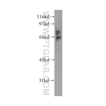 EME1 Rabbit Polyclonal Antibody (12975-1-AP)