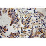 GRID1 Rabbit Polyclonal Antibody (13040-1-AP)