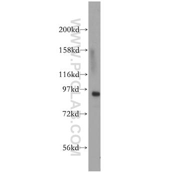 MCM4 Rabbit Polyclonal Antibody (13043-1-AP)