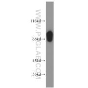 SLC27A3 Rabbit Polyclonal Antibody (12943-1-AP)