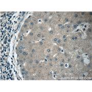 APOM Rabbit Polyclonal Antibody (12817-1-AP)