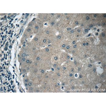 APOM Rabbit Polyclonal Antibody (12817-1-AP)