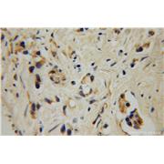 GALNT4 Rabbit Polyclonal Antibody (12897-1-AP)