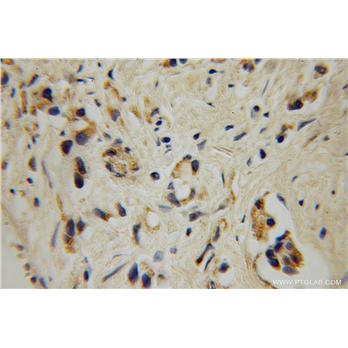GALNT4 Rabbit Polyclonal Antibody (12897-1-AP)