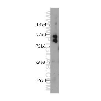CUL1 Rabbit Polyclonal Antibody (12895-1-AP)
