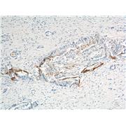 XK Rabbit Polyclonal Antibody (12830-1-AP)