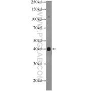 PHC2 Rabbit Polyclonal Antibody (12867-1-AP)