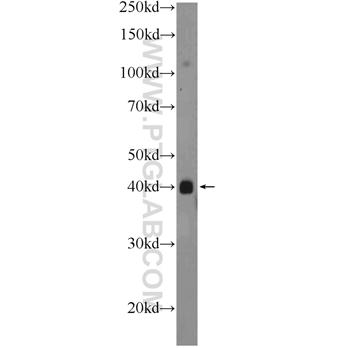 PHC2 Rabbit Polyclonal Antibody (12867-1-AP)
