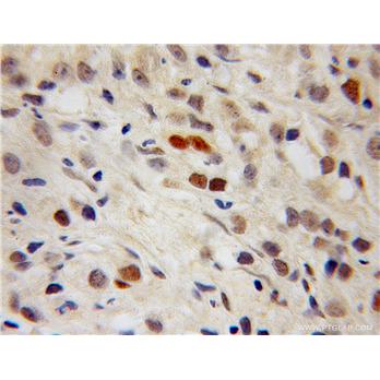 PPIG Rabbit Polyclonal Antibody (12985-1-AP)
