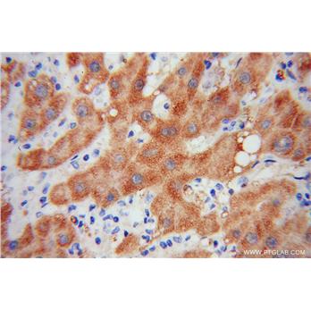 HRSP12 Rabbit Polyclonal Antibody (12930-1-AP)