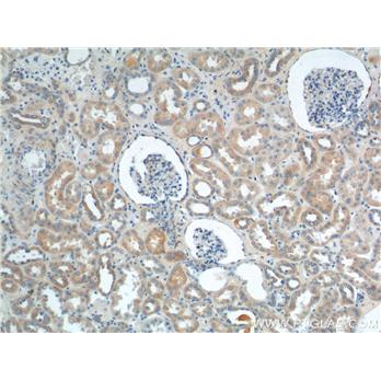 VPS26A Rabbit Polyclonal Antibody (12804-1-AP)