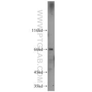 CTPS2 Rabbit Polyclonal Antibody (12852-1-AP)