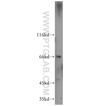 CTPS2 Rabbit Polyclonal Antibody (12852-1-AP)