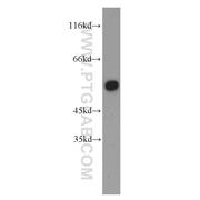 DBNL Rabbit Polyclonal Antibody (13015-1-AP)
