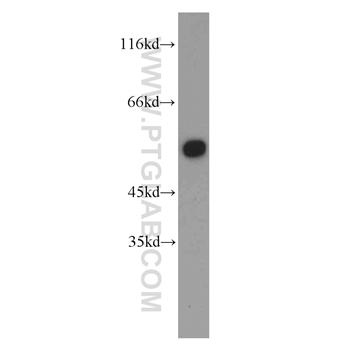 DBNL Rabbit Polyclonal Antibody (13015-1-AP)