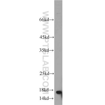 UBE2N Rabbit Polyclonal Antibody (10243-1-AP)