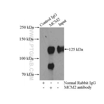 MCM2 Rabbit Polyclonal Antibody (10513-1-AP)