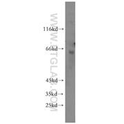 ZNF426 Rabbit Polyclonal Antibody (10386-1-AP)