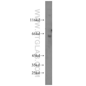 ZNF426 Rabbit Polyclonal Antibody (10386-1-AP)