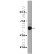 GDI1 Rabbit Polyclonal Antibody (10249-1-AP)