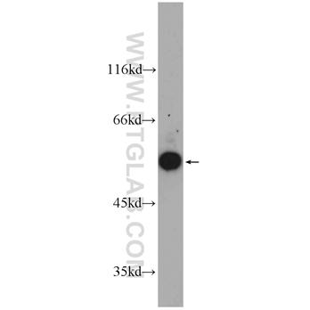 GDI1 Rabbit Polyclonal Antibody (10249-1-AP)