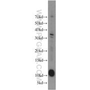 LAMA4 Rabbit Polyclonal Antibody (10465-1-AP)