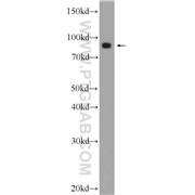 VPS35 Rabbit Polyclonal Antibody (10236-1-AP)