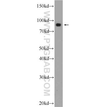 VPS35 Rabbit Polyclonal Antibody (10236-1-AP)