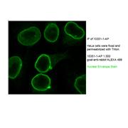 EMD Rabbit Polyclonal Antibody (10351-1-AP)