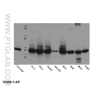 NPM1 Rabbit Polyclonal Antibody (10306-1-AP)