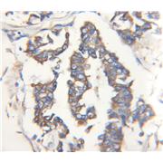 STC2 Rabbit Polyclonal Antibody (10314-1-AP)