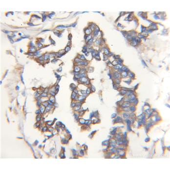STC2 Rabbit Polyclonal Antibody (10314-1-AP)