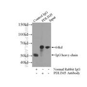 PDLIM5 Rabbit Polyclonal Antibody (10530-1-AP)
