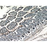 CX3CL1 Rabbit Polyclonal Antibody (10108-2-AP)
