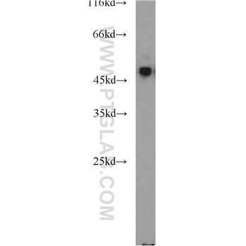 TUSC4 Rabbit Polyclonal Antibody (10157-1-AP)