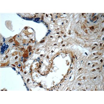 SMAD4 Rabbit Polyclonal Antibody (10231-1-AP)