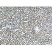 CFB Rabbit Polyclonal Antibody (10170-1-AP)