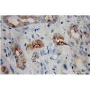 MMP7 Rabbit Polyclonal Antibody (10374-2-AP)