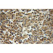 DCTN2 Rabbit Polyclonal Antibody (10030-2-AP)